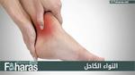 التواء الكاحل Sprained Ankle؛ تعرف على الأعراض