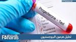 تحليل هرمون البروجسترون Progestrone؛ النسب