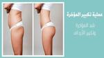 عملية تكبير المؤخرة (Buttock Enhancement)؛