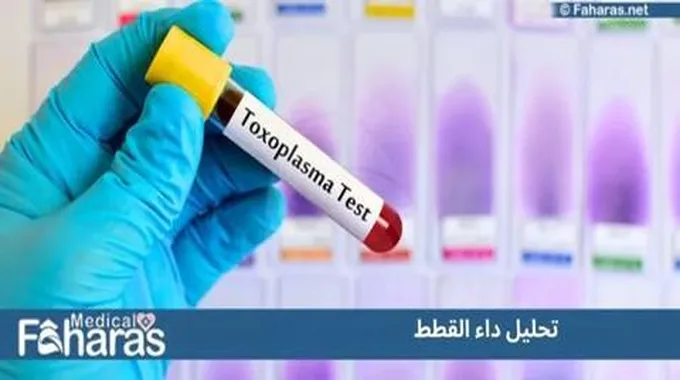 تحليل داء القطط (Toxoplasma Test)؛ تعرف على أهم